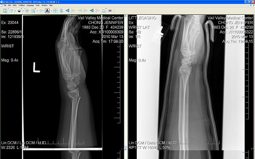 xray